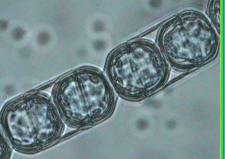 Dictyocha speculum